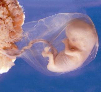 12 Weeks